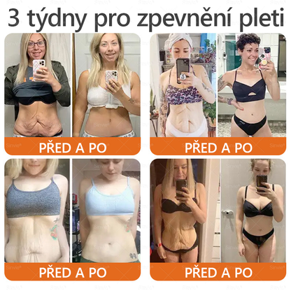 🎁 Zbývá už jen 5 krabiček. Nabízíme vám dodatečnou 70% slevu! Udržujte si zdravou postavu. Pokud to teď propásnete, příští rok už nebudete mít šanci.
