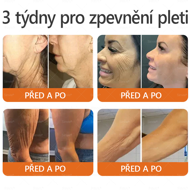 🎁 Zbývá už jen 5 krabiček. Nabízíme vám dodatečnou 70% slevu! Udržujte si zdravou postavu. Pokud to teď propásnete, příští rok už nebudete mít šanci.