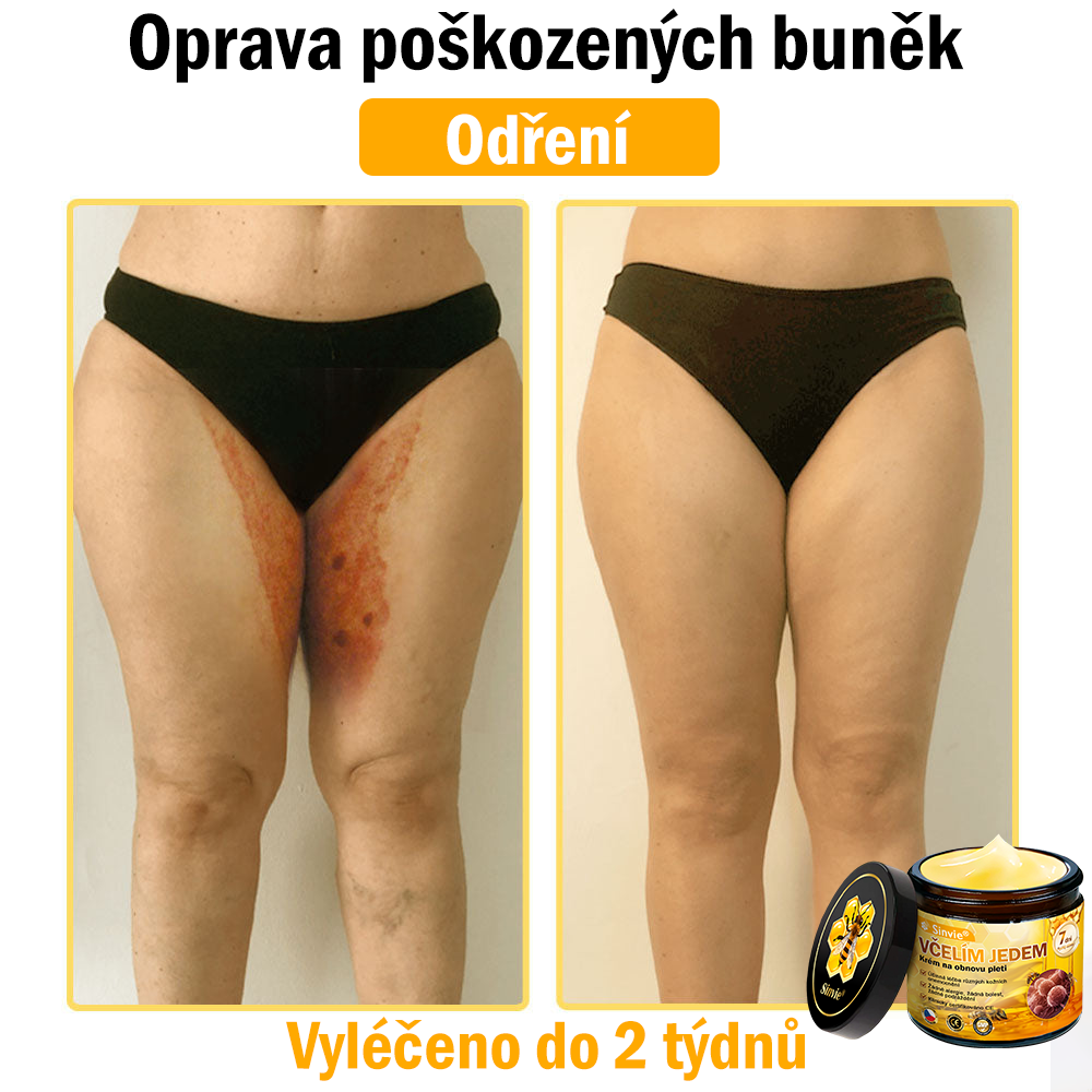 🎁 Zbývá už jen 5 krabiček. Nabízíme vám dodatečnou 70% slevu! Udržujte si zdravou postavu. Pokud to teď propásnete, příští rok už nebudete mít šanci.